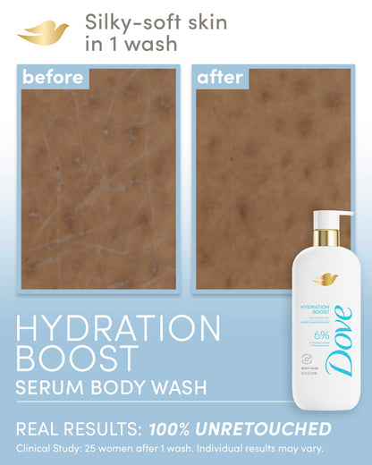 Dove Body Wash Hydration Boost Actively drenches dry skin 6% hydration serum with hyaluronic 30 Fl Oz - Renee Lane Company