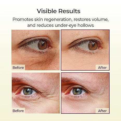 Dr.Melaxin Cemenrete Calcium Multi Balm 9g Korean Skin Care All In One Calcium Volume Stick Collagen Wrinkles Face Eye treatment Balm - Renee Lane Company