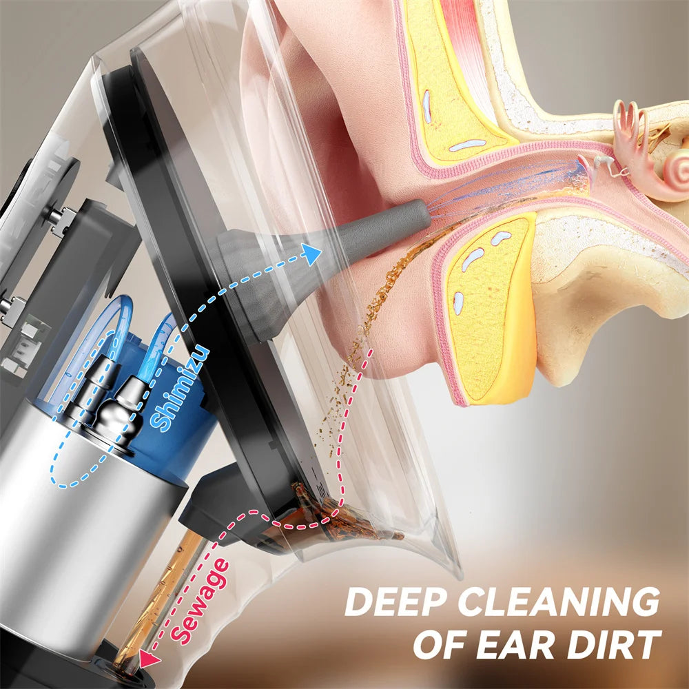 Ear Wax Water Flusher - Renee Lane Company
