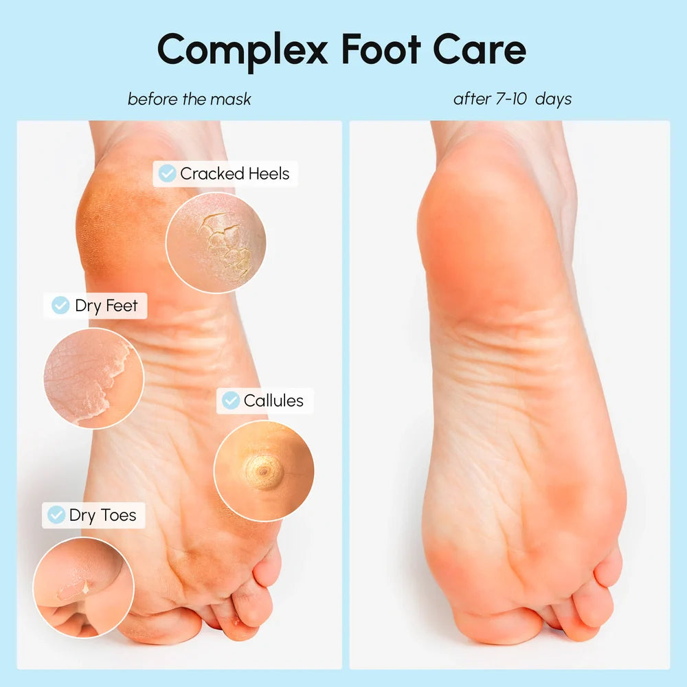 Exfoliating & Hydrating Foot Mask - Renee Lane Company