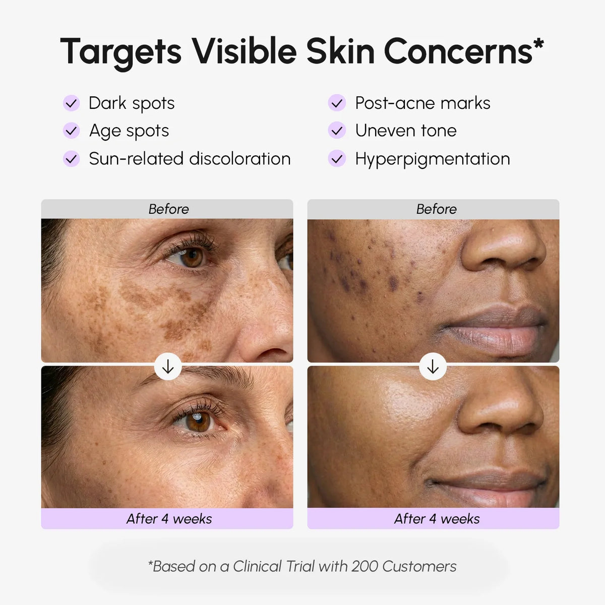Face & Body Serum for Dark Spots - Renee Lane Company