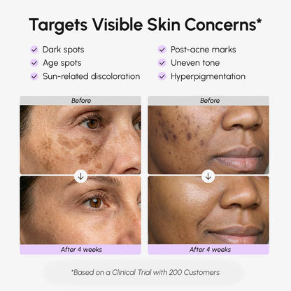 Face & Body Serum for Dark Spots - Renee Lane Company