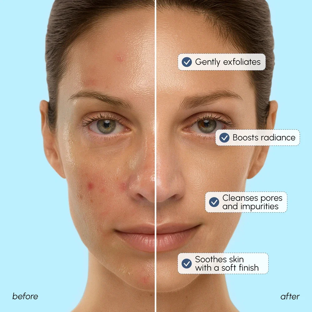 Face Polishing Scrub & Exfoliator - Renee Lane Company