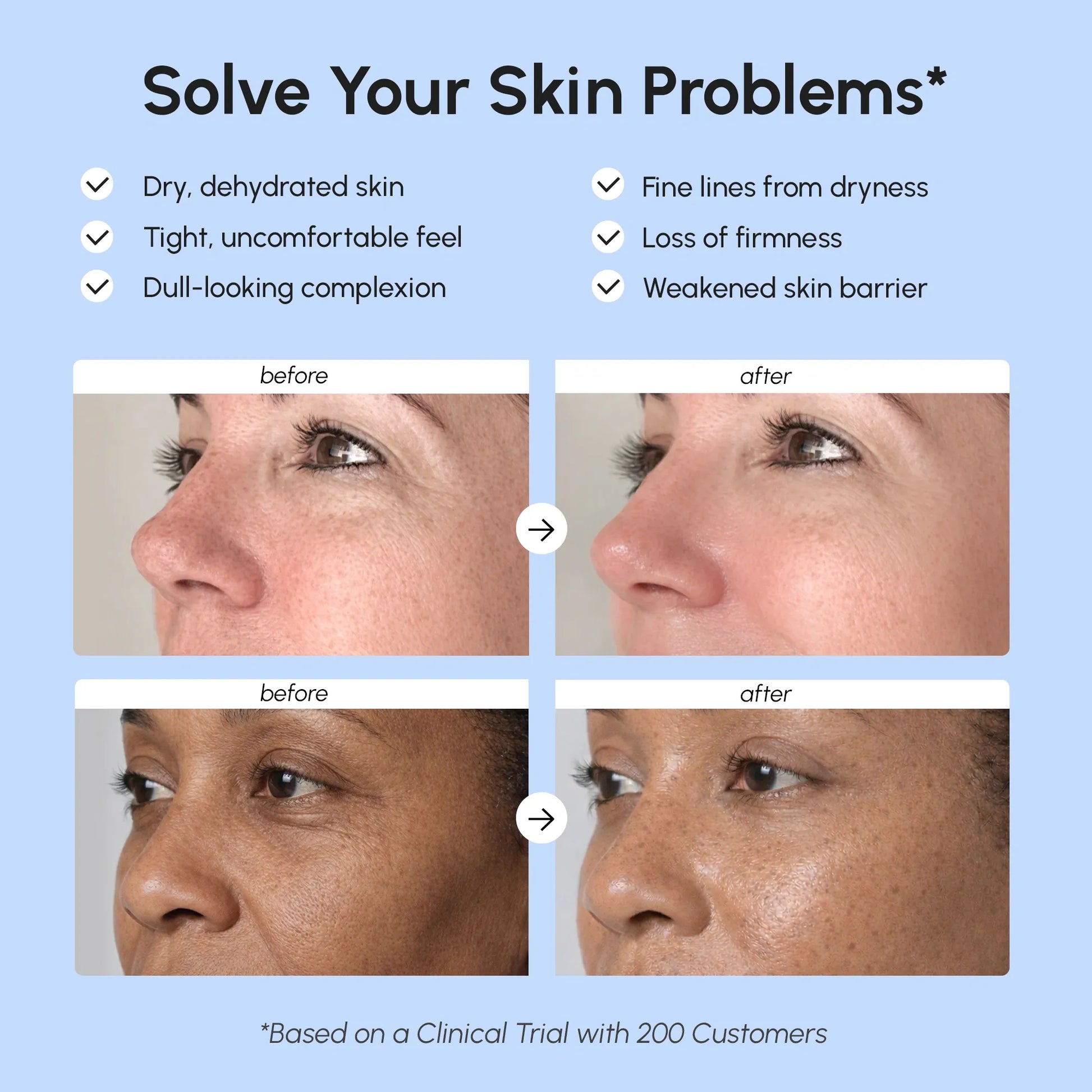 Firming & Lifting Collagen Moisturizer - Renee Lane Company