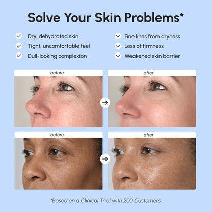 Firming & Lifting Collagen Moisturizer - Renee Lane Company
