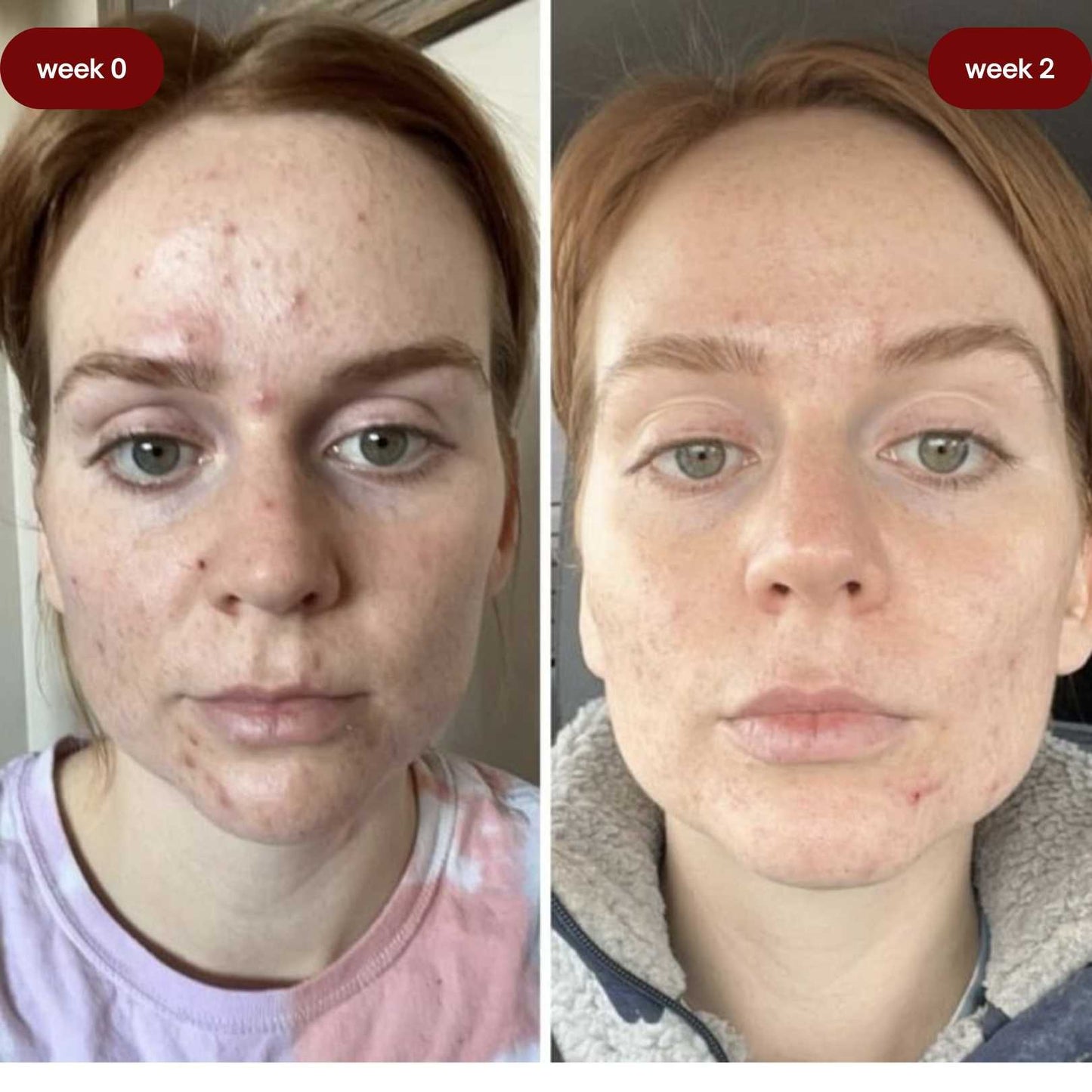 Full Skincare Routine Kit for Flawless Skin by Blisfull Skin - Renee Lane Company