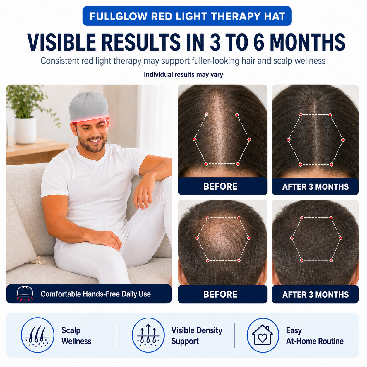 FullGlow Red Light and Infrared Therapy Hat - Renee Lane Company
