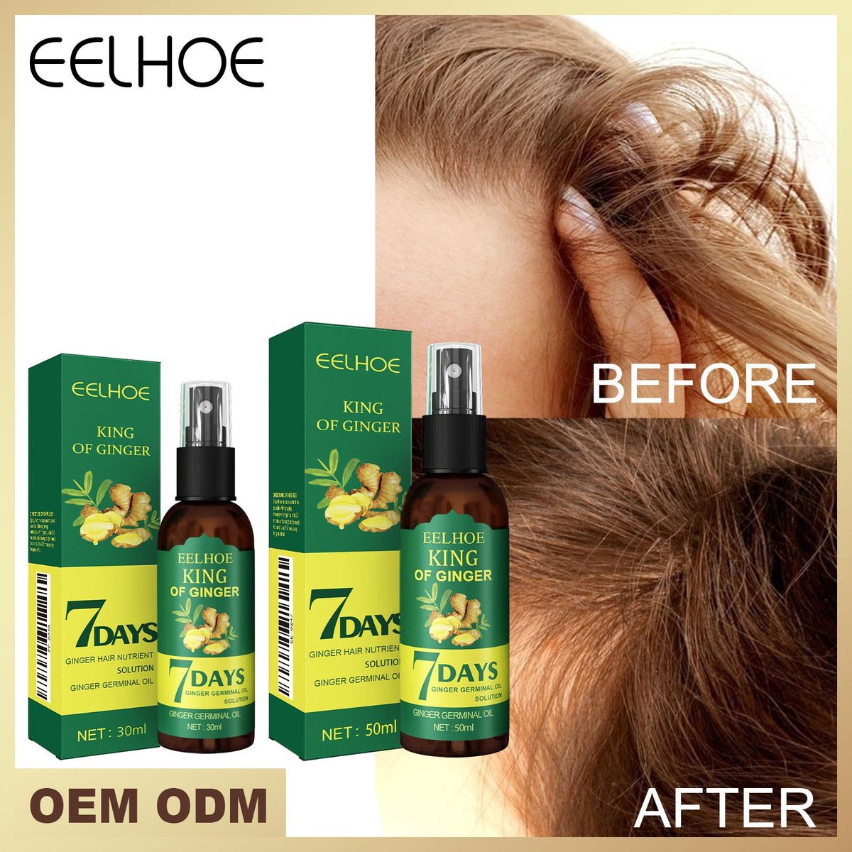 Hair root spray bottles and green EELHOE King of Ginger 7 Days cartons with hair close-up