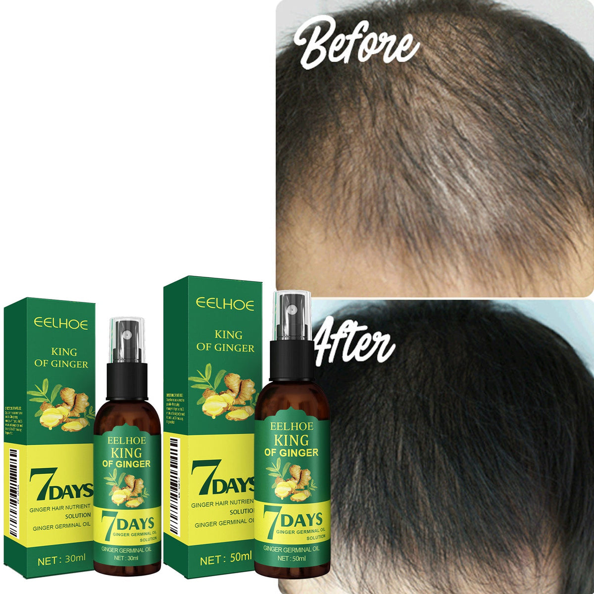 Hair root spray bottle and EELHOE King of Ginger 7 Days packaging beside scalp comparison
