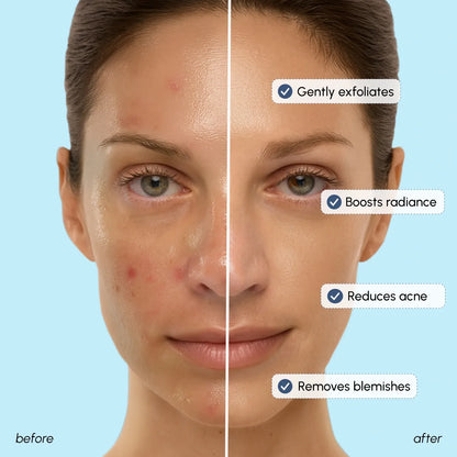 Glow Boost Glycolic Face Toner - Renee Lane Company