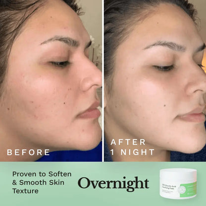 Skincare before-and-after close-up with peel pad jar shown at lower right