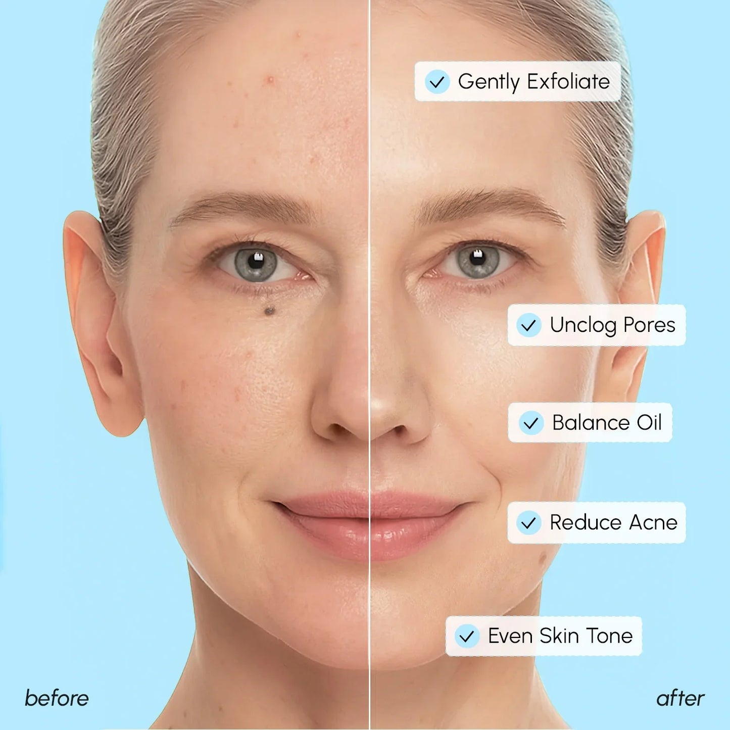 Glycolic & Salicylic Acid Peel Pads - Renee Lane Company