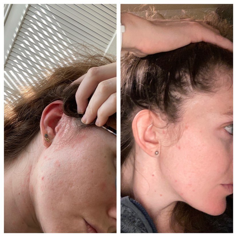 GoodBiome®️ Prebiotic Facial Solution: Liquid AHA + BHA Serum - Renee Lane Company