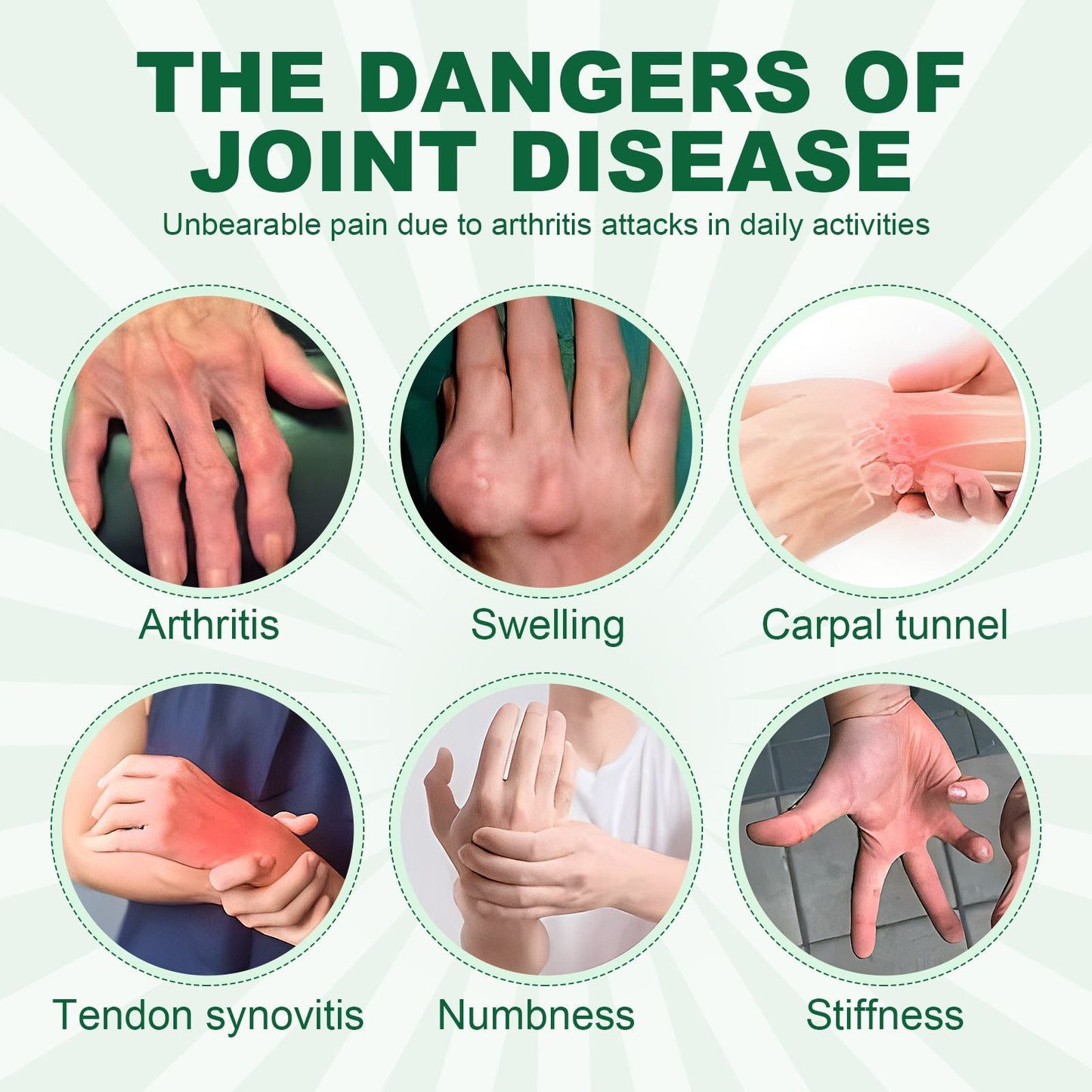 Houkea Joint Care Gloves Relieve Thumb Stiffness And Finger Joint Soreness And Swelling Discomfort Care Gloves - Renee Lane Company