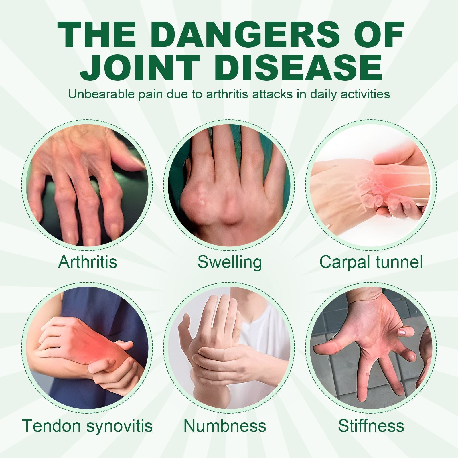 Houkea Joint Care Gloves Relieve Thumb Stiffness And Finger Joint Soreness And Swelling Discomfort Care Gloves - Renee Lane Company