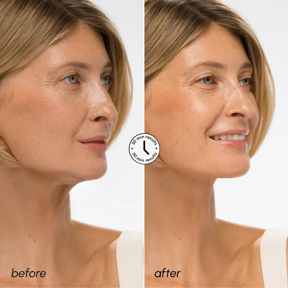 Hyaluronic Acid V-line Lifting Mask - Renee Lane Company