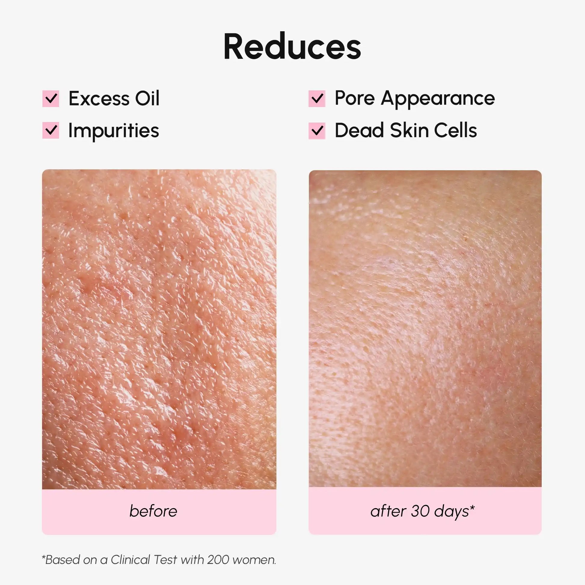 Hydrating Pore Refining Toner - Renee Lane Company