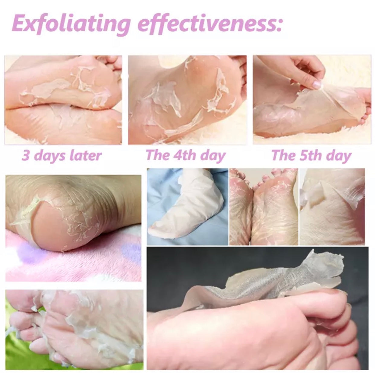 Foot exfoliating peel mask set with wrap-style treatment for pedicure