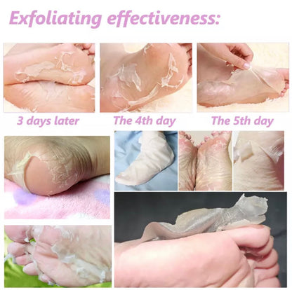Foot exfoliating peel mask set with wrap-style treatment for pedicure