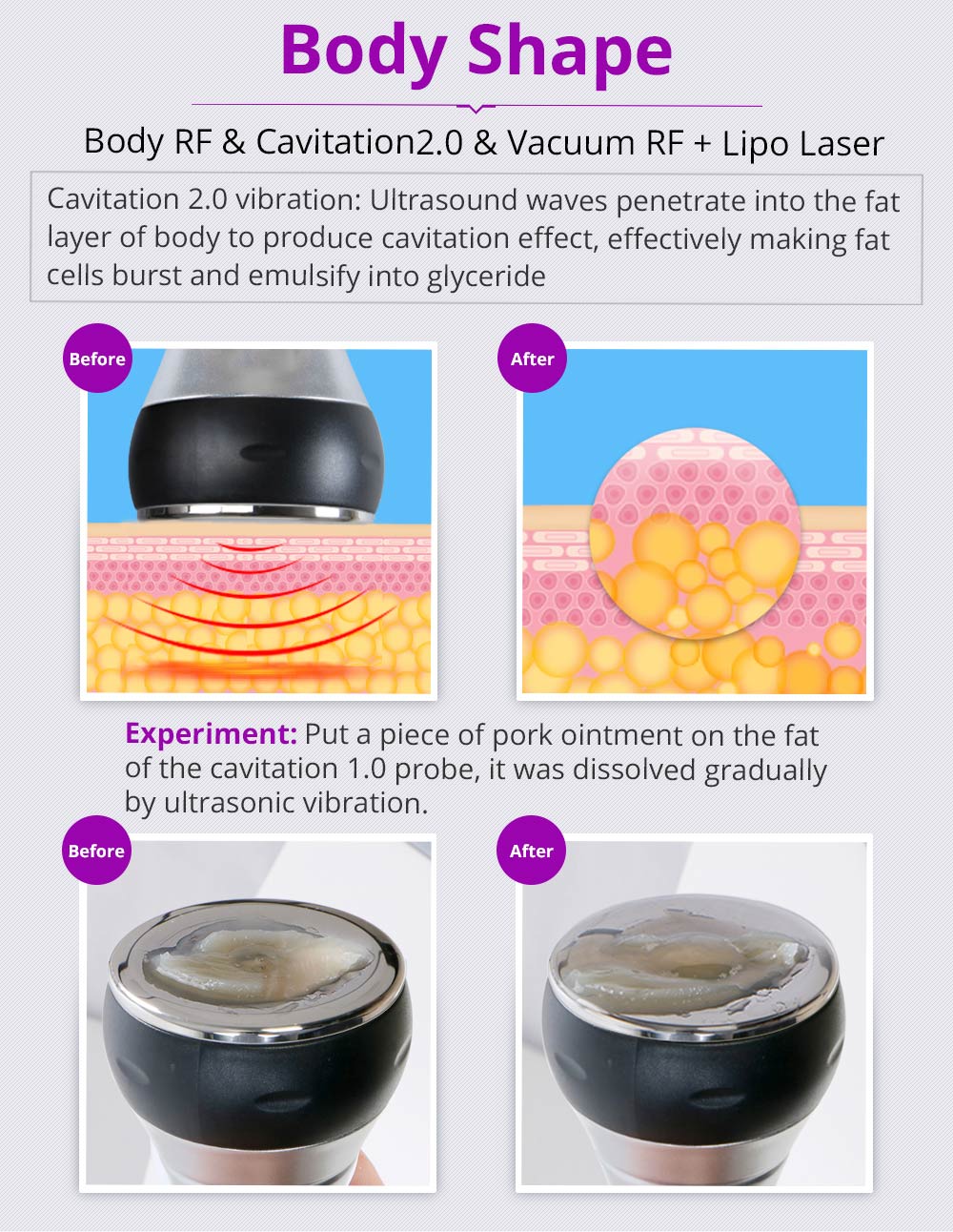 Kim 10 6-in-1 Cavitation RF Lipo Laser System - Renee Lane Company