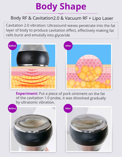 Kim 10 6-in-1 Cavitation RF Lipo Laser System - Renee Lane Company