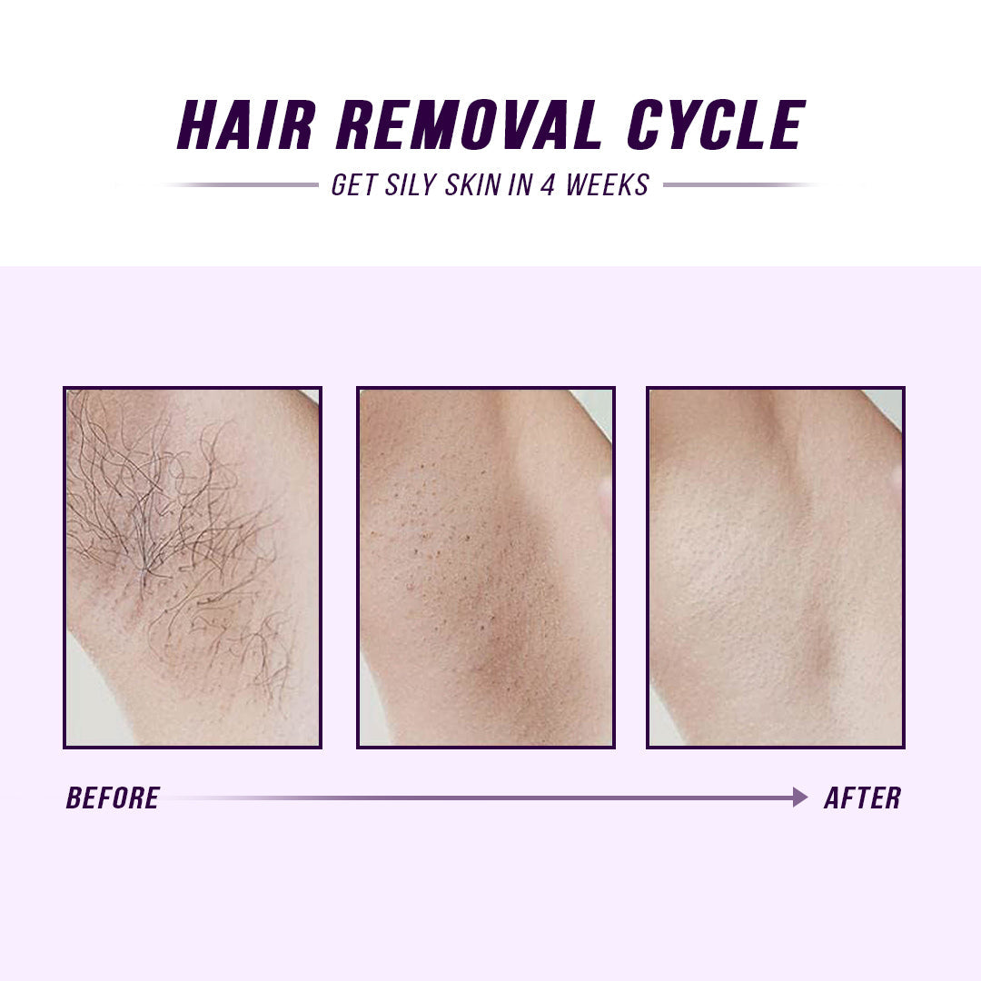Laser IPL Hair Removal - Renee Lane Company