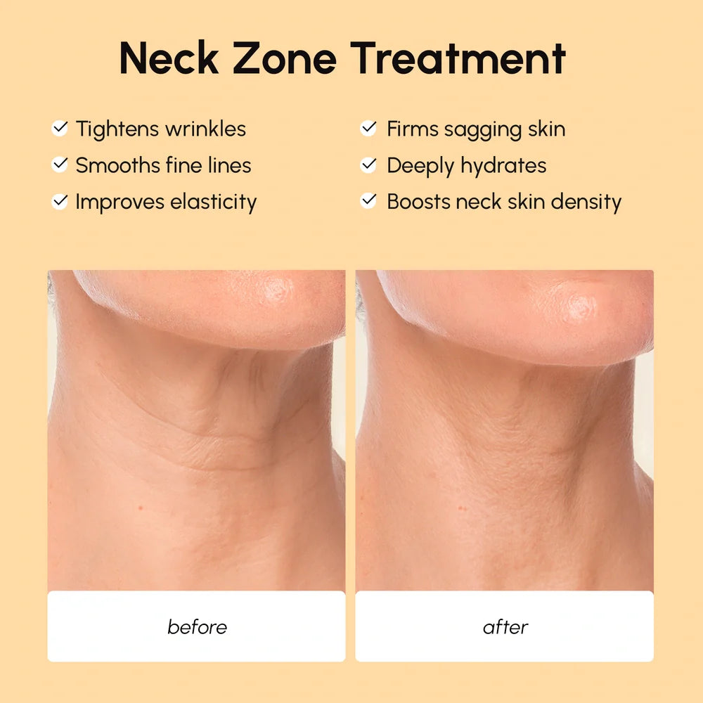 Lifting Neck Wrinkle Patches - Renee Lane Company