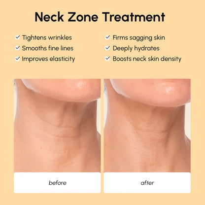 Lifting Neck Wrinkle Patches - Renee Lane Company