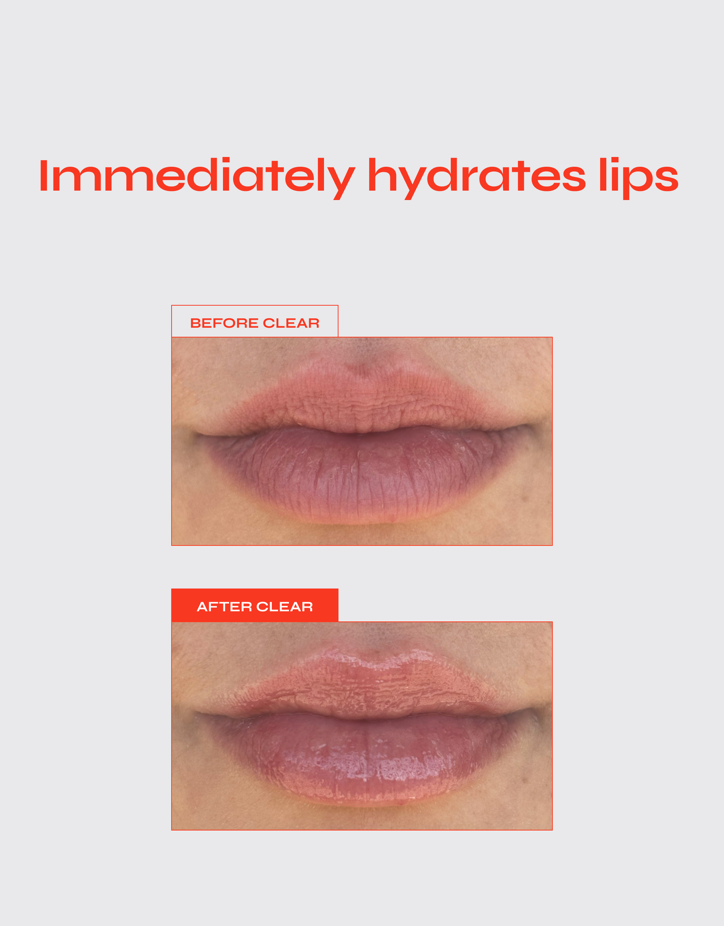 Lip Jelly - Renee Lane Company
