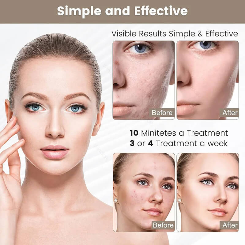 LED beauty mask with white face panel, shown with before-and-after treatment views