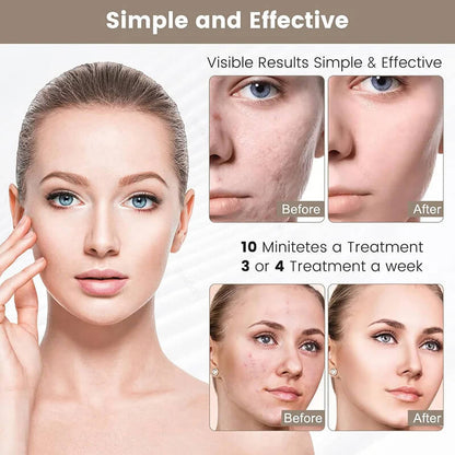 LED beauty mask with white face panel, shown with before-and-after treatment views
