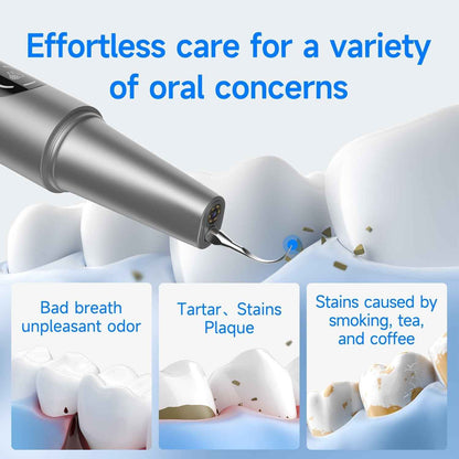M1 Ultrasonic Tooth Cleaner | Professional Plaque & Tartar Removal - Renee Lane Company
