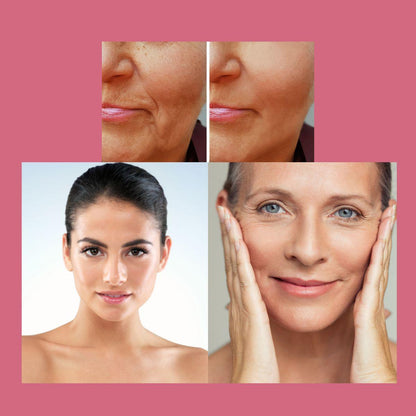 Four-panel face collage showing skin before and after care on two women