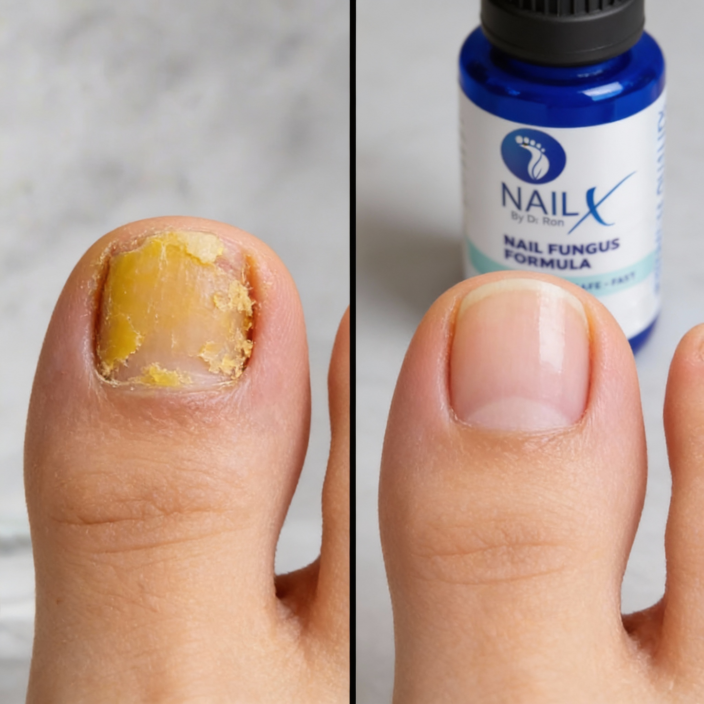 NailX Topical Nail Solution – Repair for Discolored, Damaged & Fungal-Prone Nails - Renee Lane Company