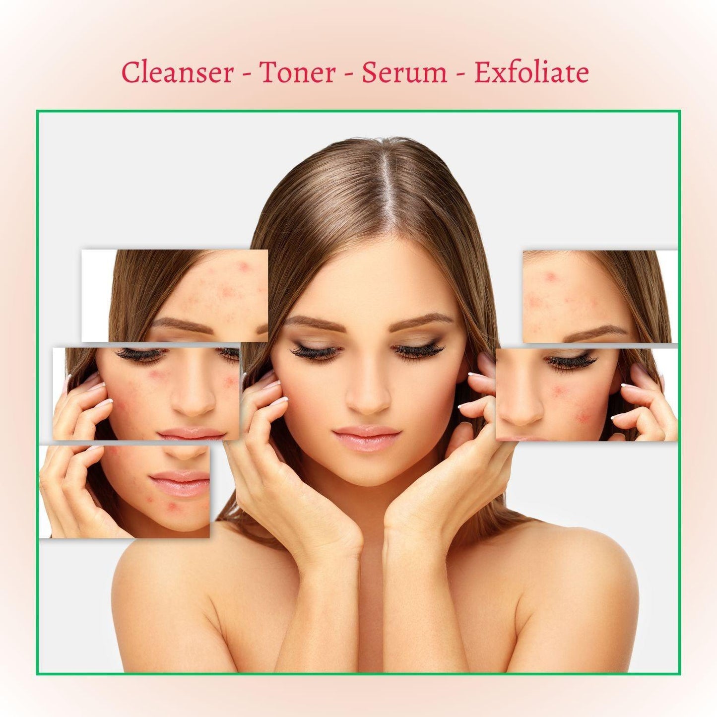 New Skin Natural Intensive Acne Serum - Renee Lane Company