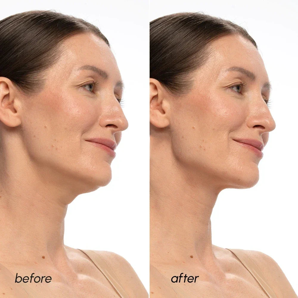 PDRN V-line Lifting Mask - Renee Lane Company