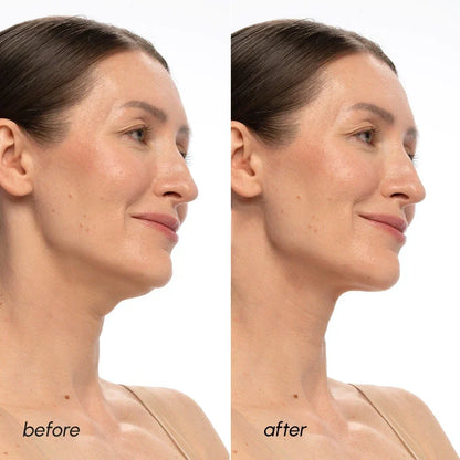 PDRN V-line Lifting Mask - Renee Lane Company
