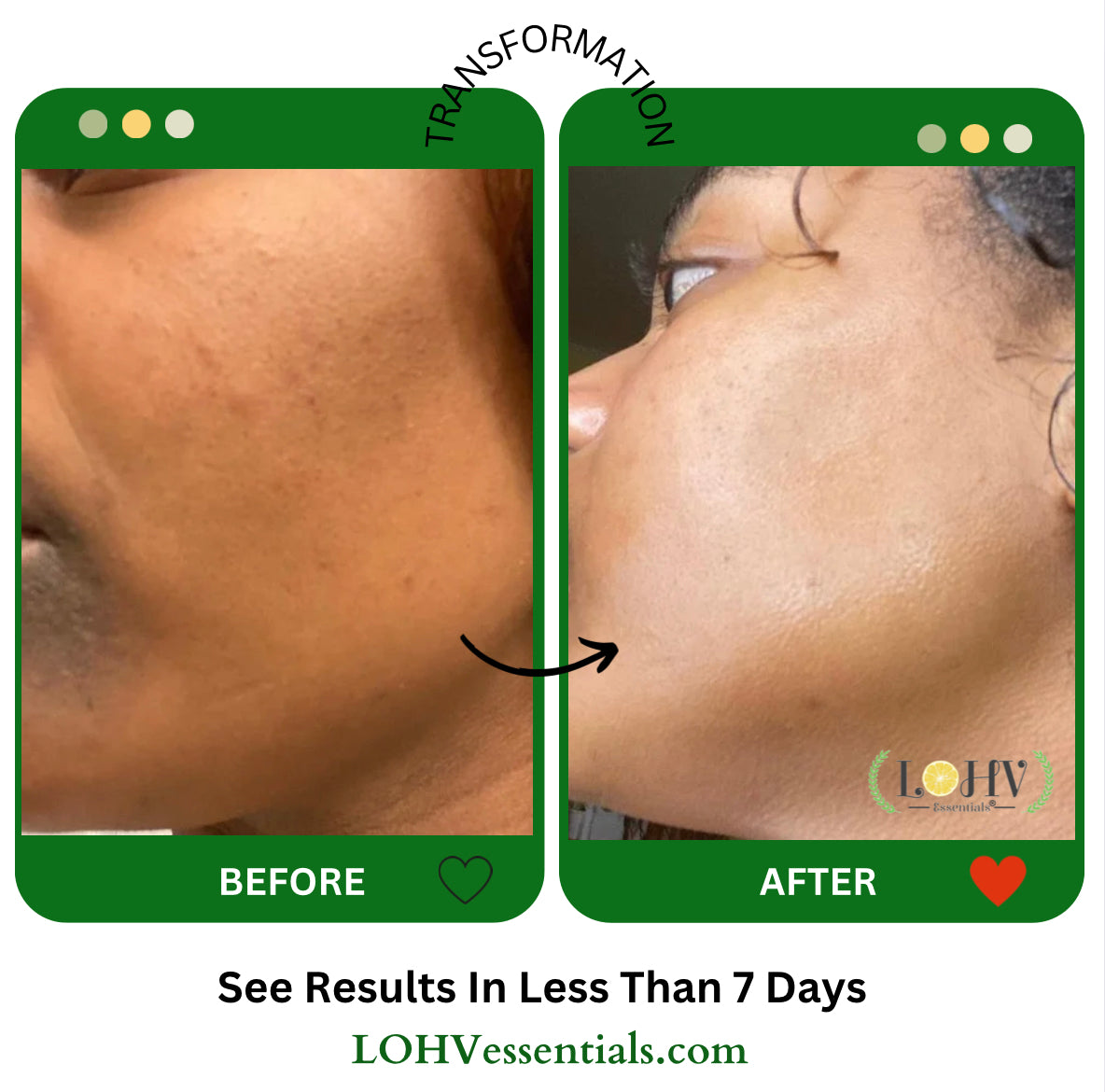 PREMIUM 100% VEGAN GLOW UP Toner Serum With Hyaluronic Acid + Niacinamide + Camellia Leaf + Vitamin E + Rose Water - Renee Lane Company