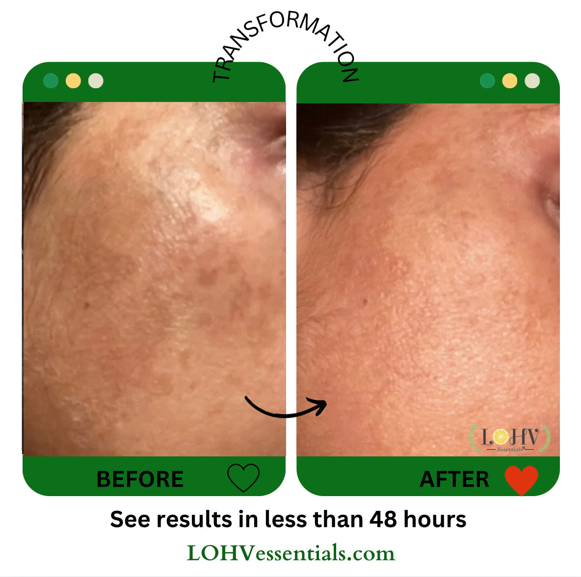 PREMIUM 100% VEGAN Rejuvenating JELLY FACE MASK With Retinol + Turmeric + Aloe Vera + Lactic acid + Rosemary Leaf - Renee Lane Company