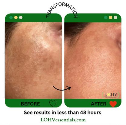 PREMIUM 100% VEGAN Rejuvenating JELLY FACE MASK With Retinol + Turmeric + Aloe Vera + Lactic acid + Rosemary Leaf - Renee Lane Company