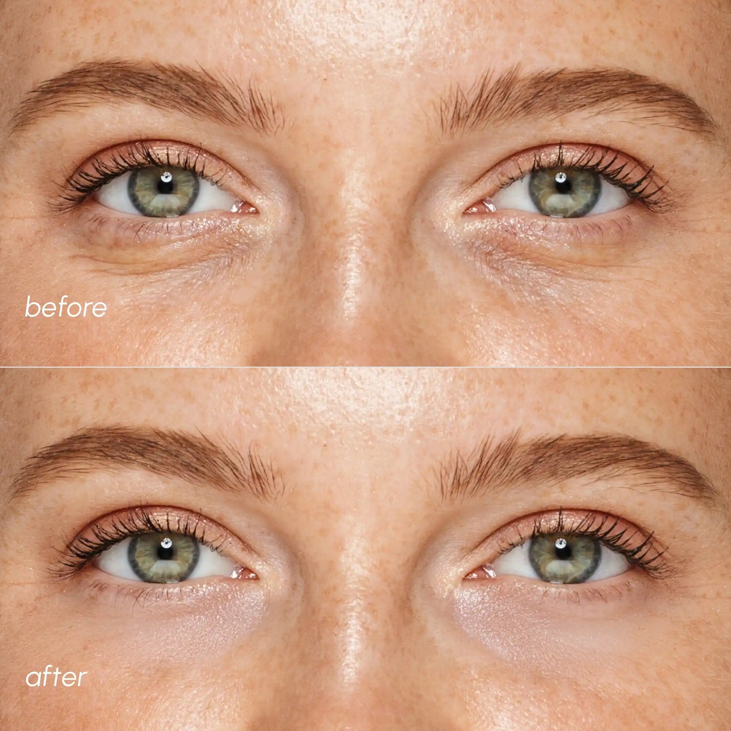 Pink Eye Patches for Puffy Eyes - Renee Lane Company
