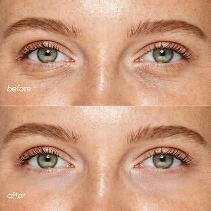 Pink Eye Patches for Puffy Eyes - Renee Lane Company