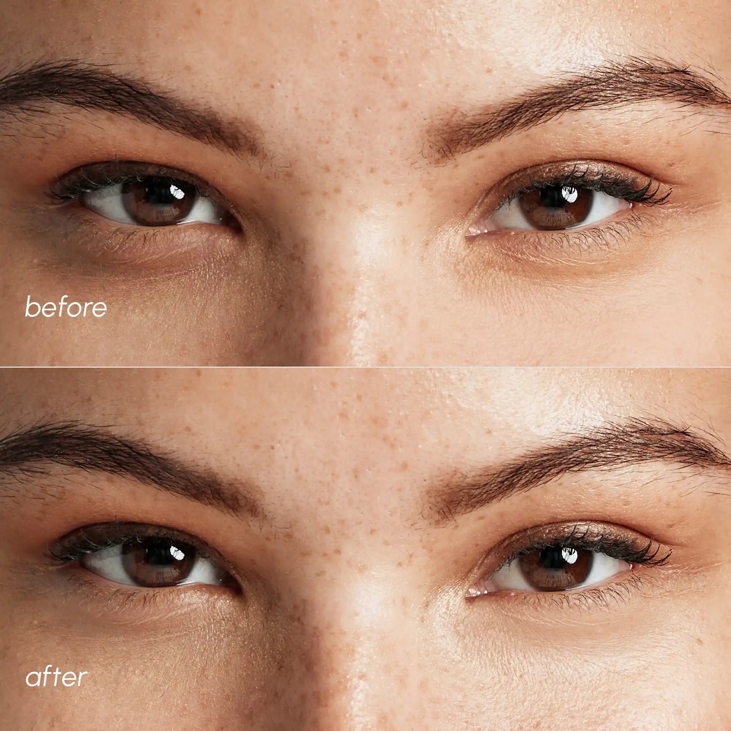 Pink Eye Patches for Puffy Eyes - Renee Lane Company