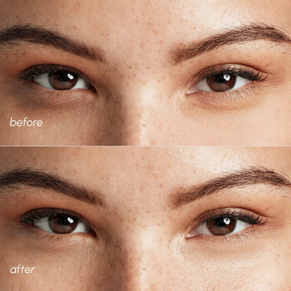 Pink Eye Patches for Puffy Eyes - Renee Lane Company