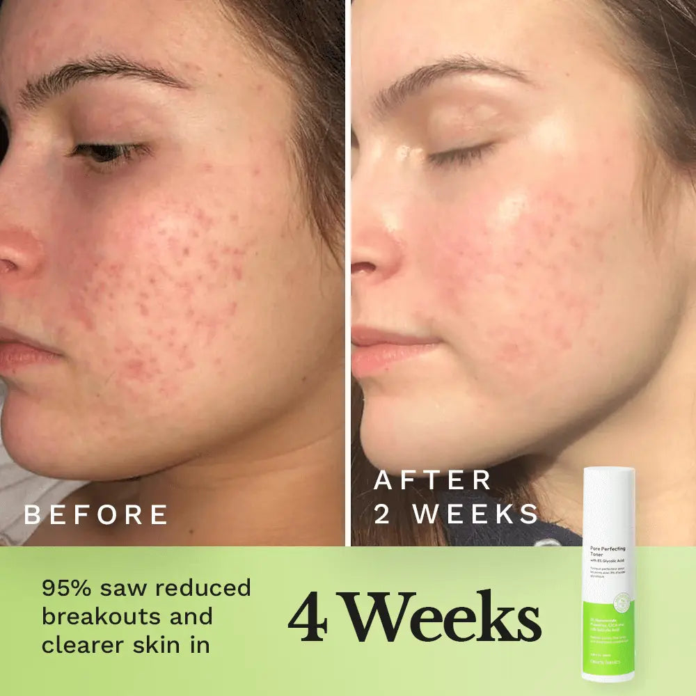 Pore Perfecting Toner - Renee Lane Company