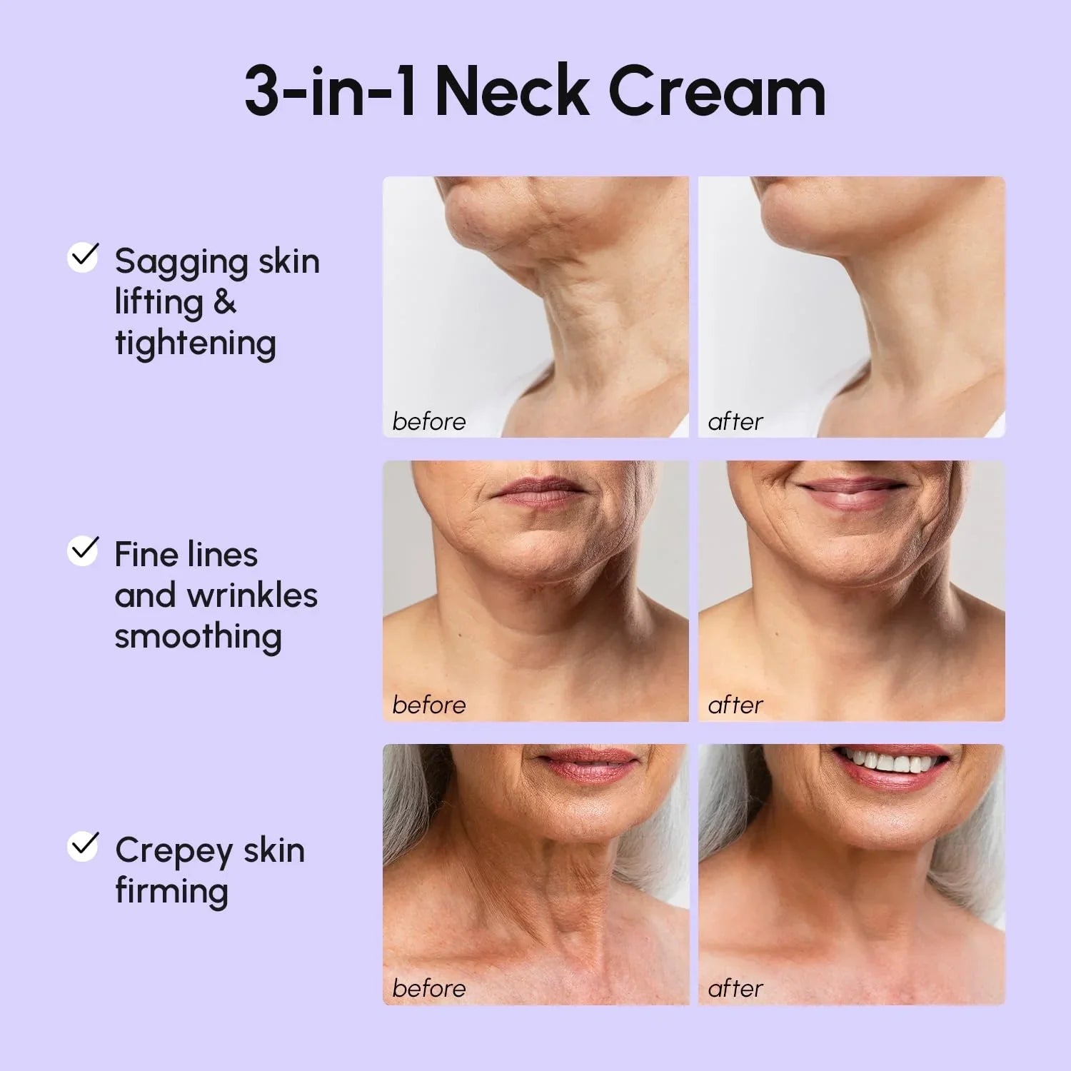 Pro-Retinol Neck Lifting Cream Massager - Renee Lane Company