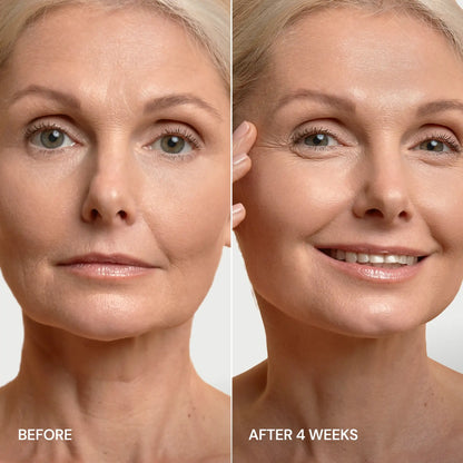 Pro-Retinol Neck Lifting Cream Massager - Renee Lane Company