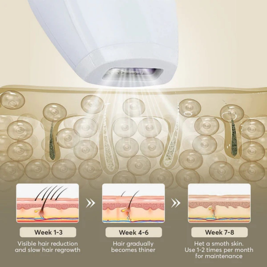 Hair reduction progress illustration showing treated skin layers and thinning hair strands