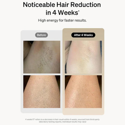 Before-and-after leg hair reduction results illustration with smoother skin after treatment