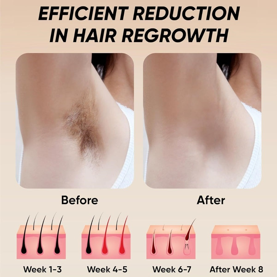 IPL hair removal epilator results on leg skin, before and after